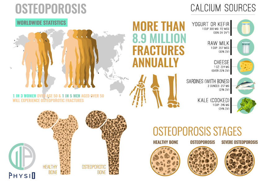 osteoporosis-physio-treatment-london-wimbledon-sw19