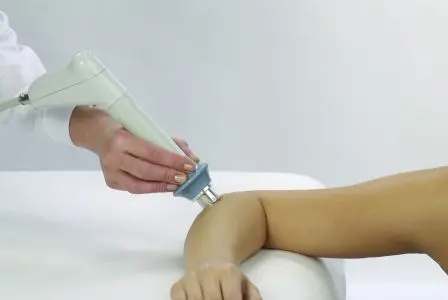 radial shock wave therapy at wimbledon clinic physio on elbow