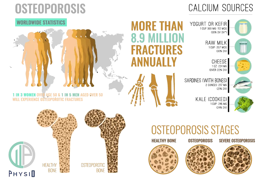 osteoporosis-physio-treatment-london-wimbledon-sw19
